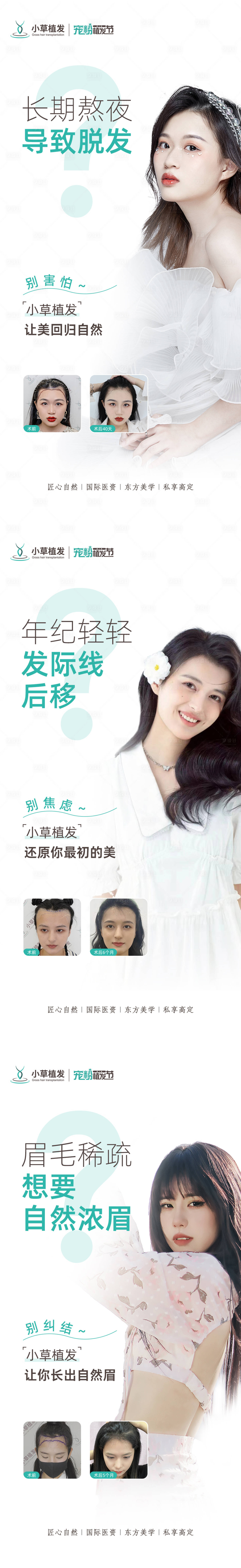源文件下載【享設(shè)計(jì)】搜索編號(hào)：87480012107162408【植發(fā)創(chuàng)意海報(bào)】