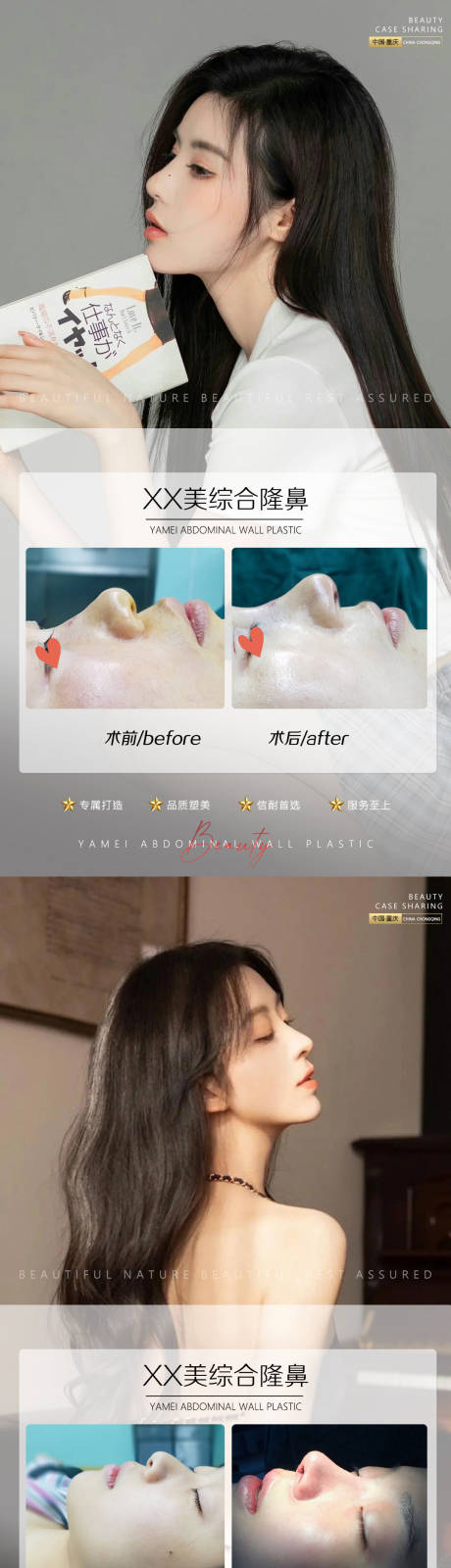 源文件下载【享设计】搜索编号：67950012220563035【医美案例鼻子系列海报】