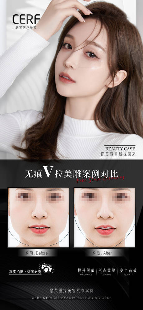源文件下载【享设计】搜索编号：97170012349126613【医美前后对比照海报】