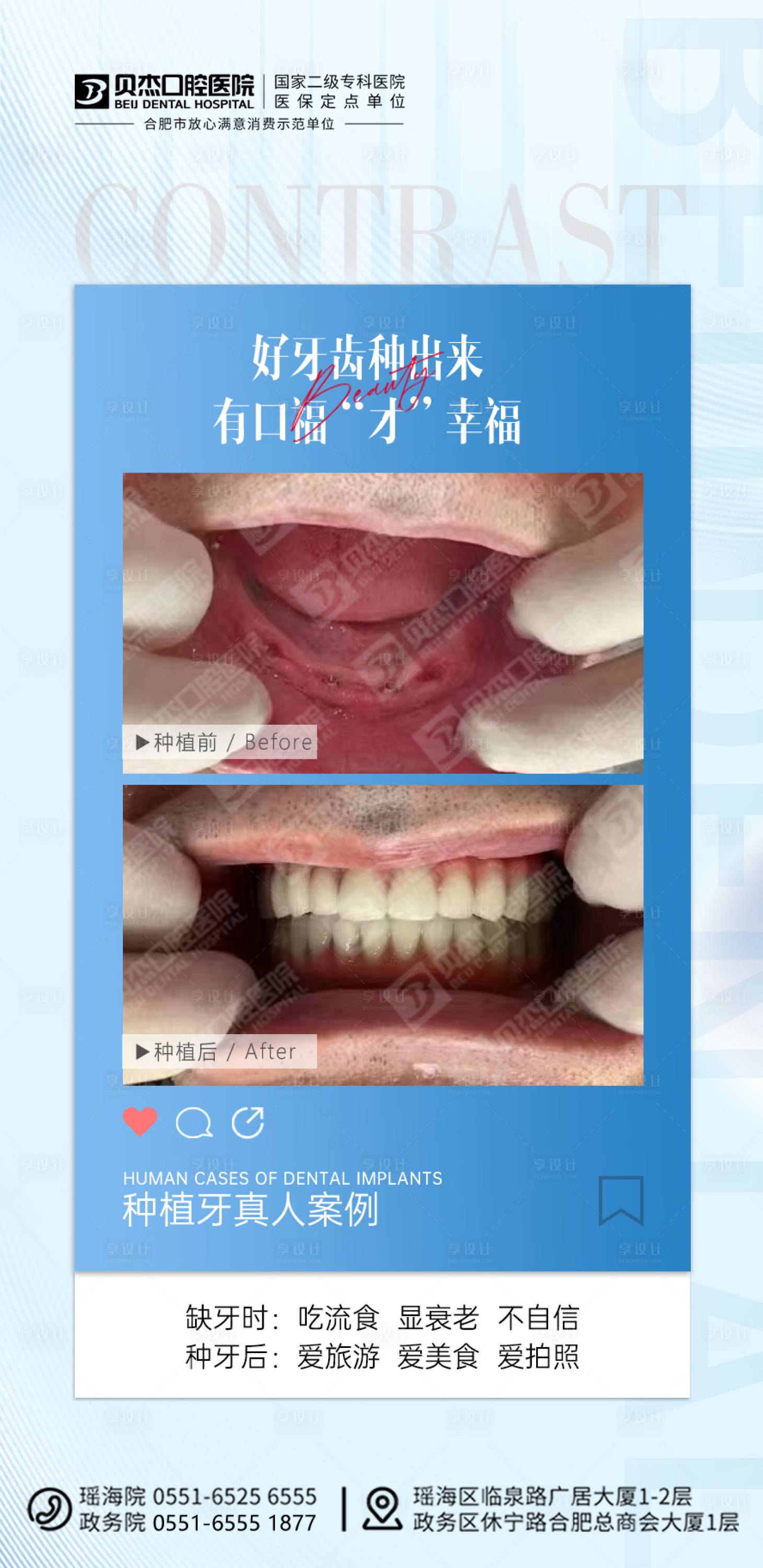 源文件下载【享设计】搜索编号：45960012378562987【种植牙案例海报】