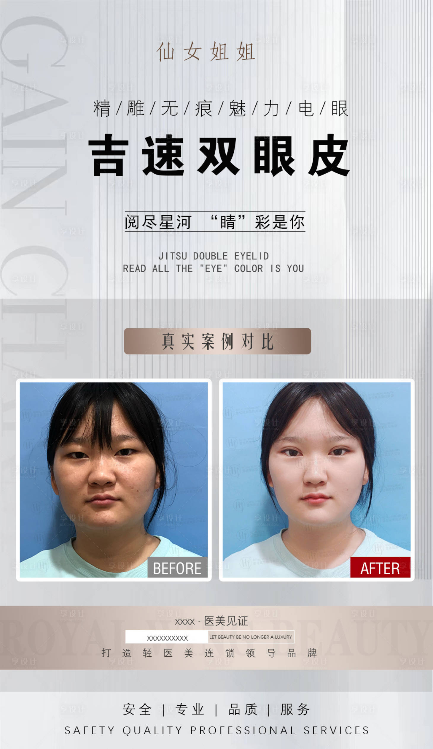 源文件下載【享設計】搜索編號：22510012496202921【雙眼皮對比圖】