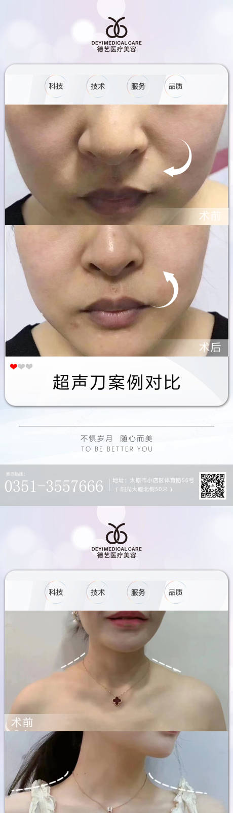 源文件下載【醫(yī)美案例對(duì)比圖】編號(hào)：39540011980411453