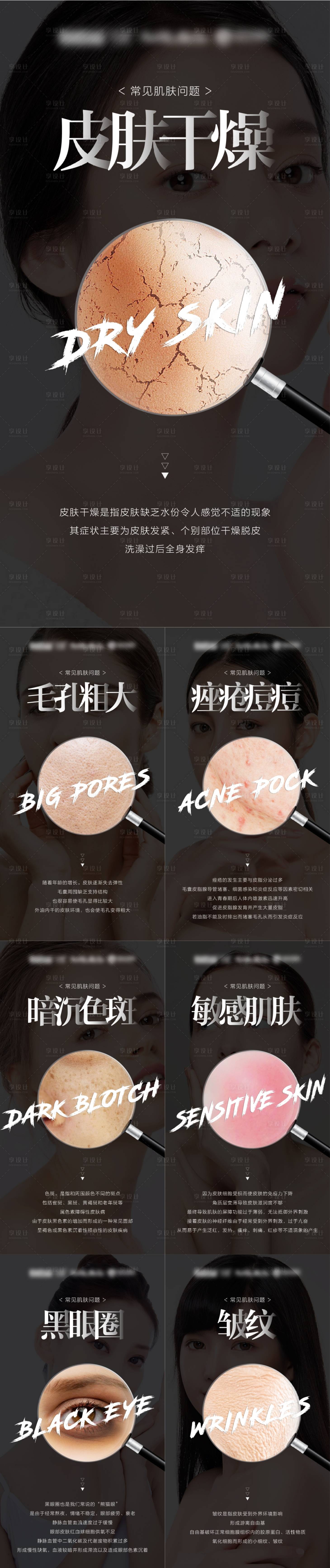源文件下载【常见肌肤问题大字报系列海报】编号：84910012181779193