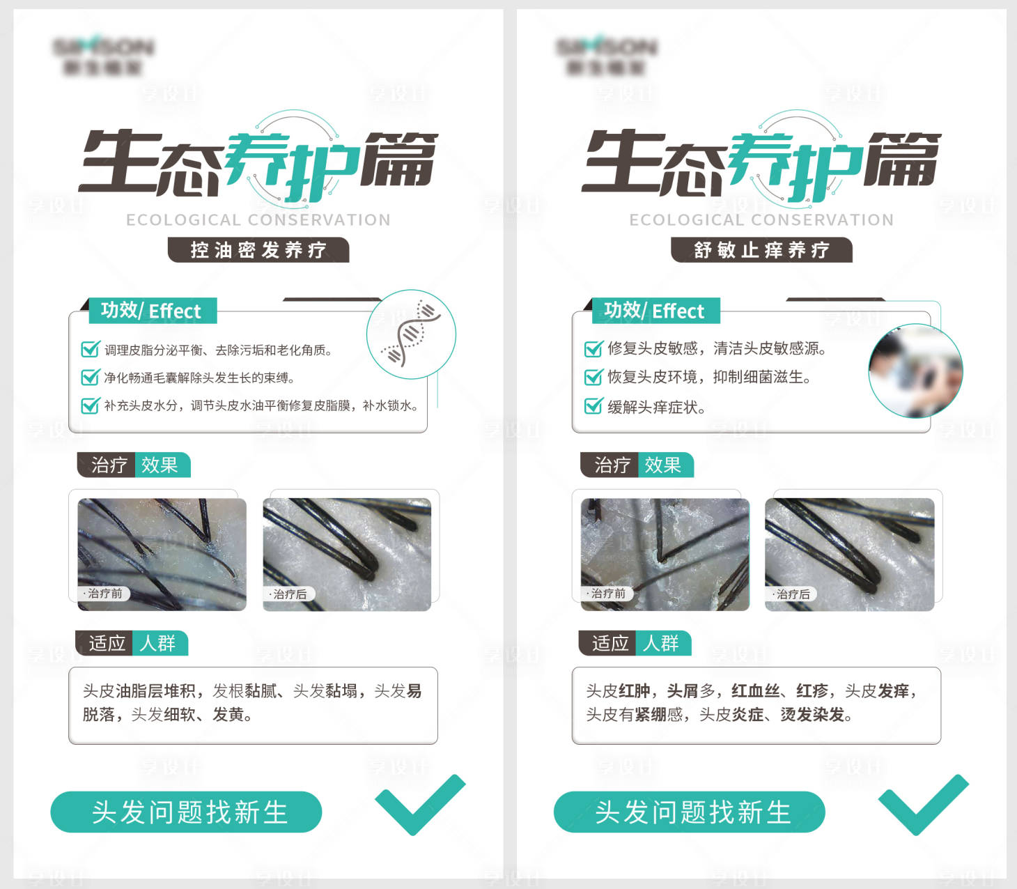 源文件下载【医美植发养护项目介绍海报】编号：92360012372621546