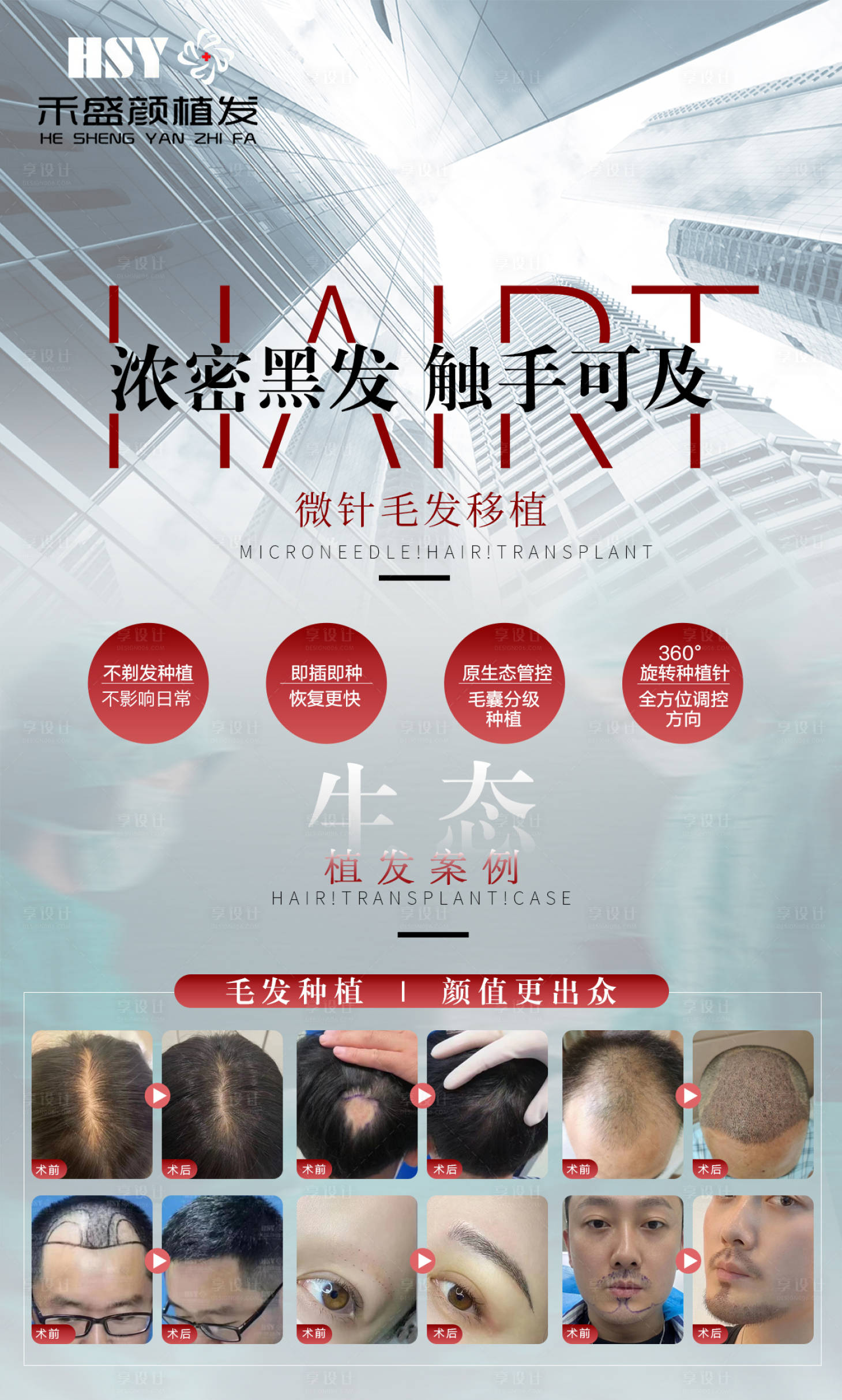 源文件下載【享設計】搜索編號：41980012472142373【植發活動 植發朋友圈】