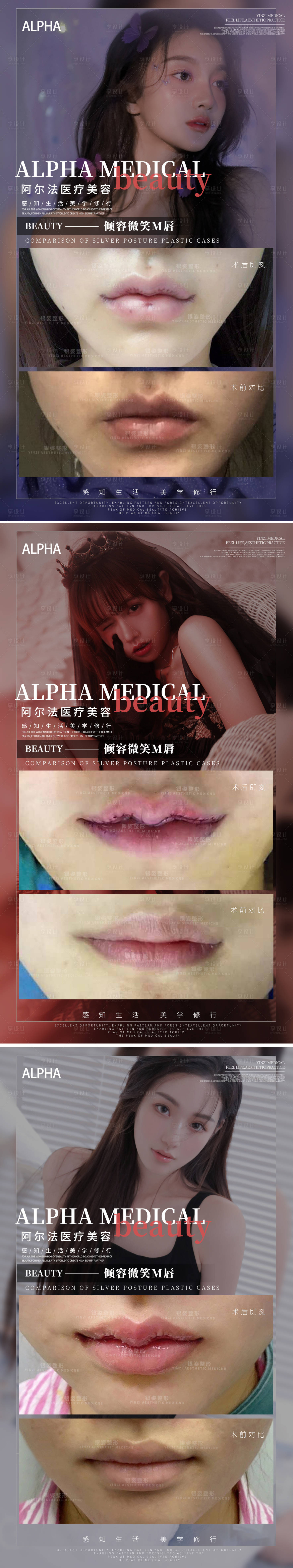 源文件下載【享設(shè)計】搜索編號：90900012262098321【醫(yī)美M唇案例系列海報】