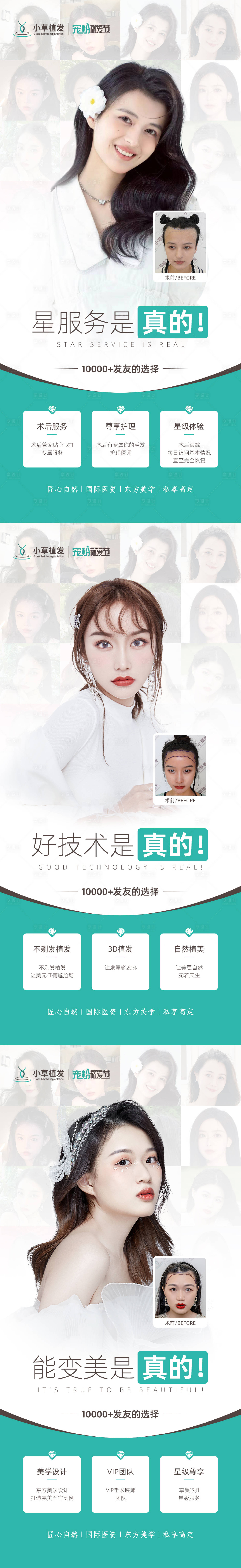 源文件下载【享设计】搜索编号：46280012252094499【《植发创意海报》】