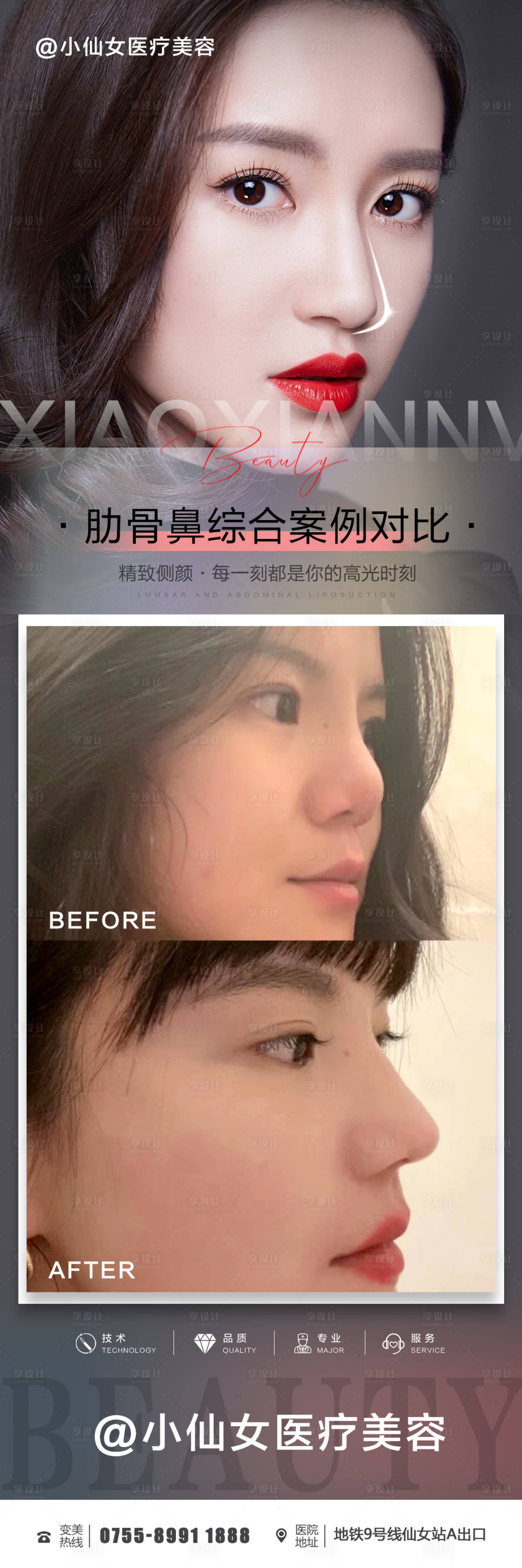 源文件下载【享设计】搜索编号：41680012317856894【医美鼻综合案例海报】