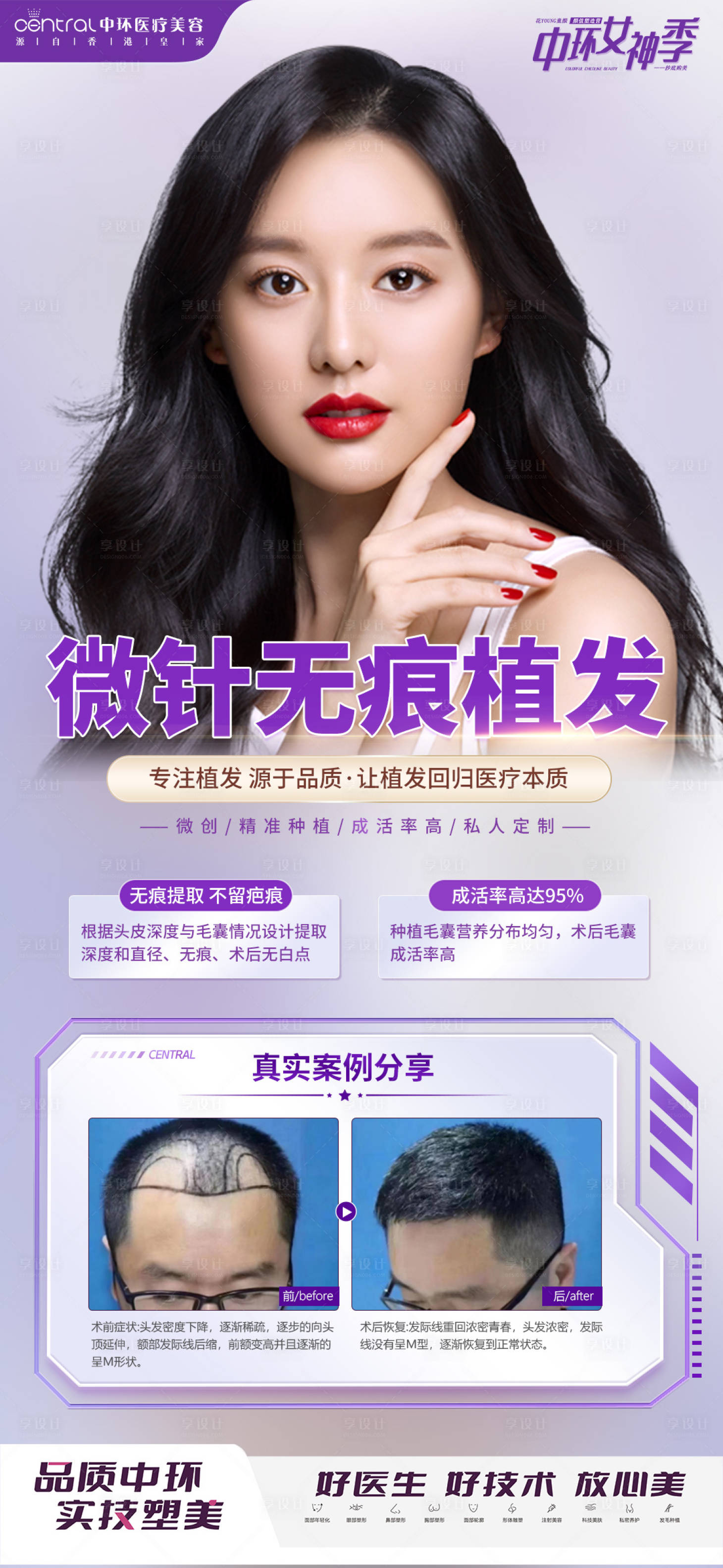源文件下载【医美植发项目案例对比海报】编号：18610012404098301