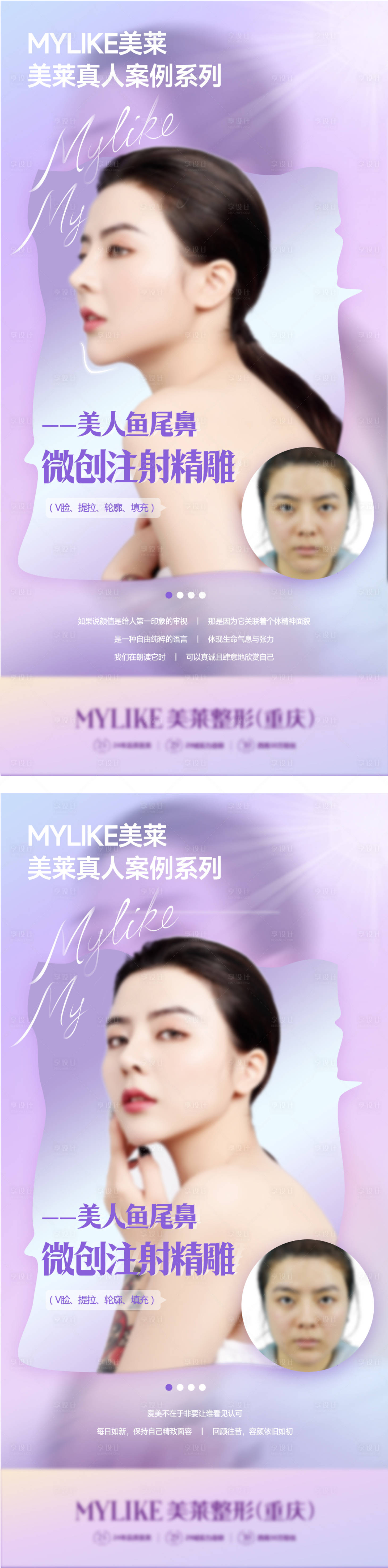 源文件下载【医美微创皮肤案例海报】编号：17510012142548980