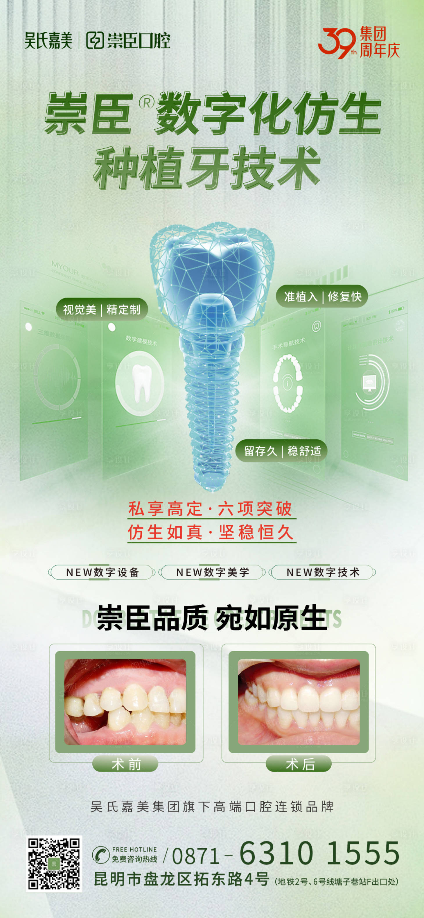 源文件下載【享設(shè)計】搜索編號：28400012161638182【種植牙海報】