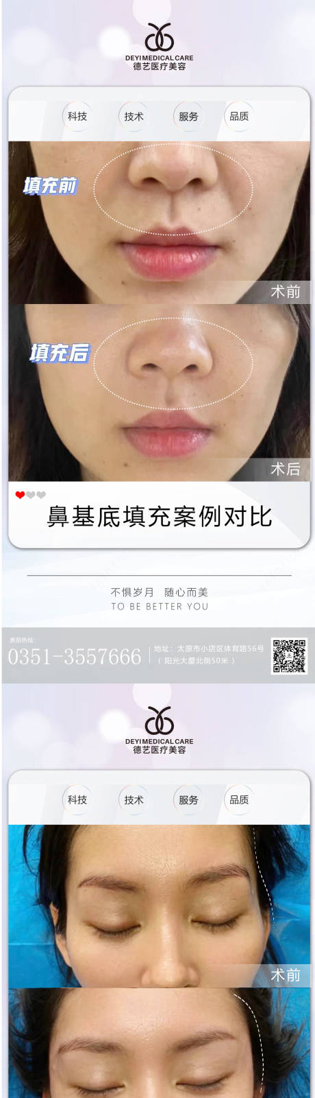源文件下载【医美案例对比图】编号：46540011979886525