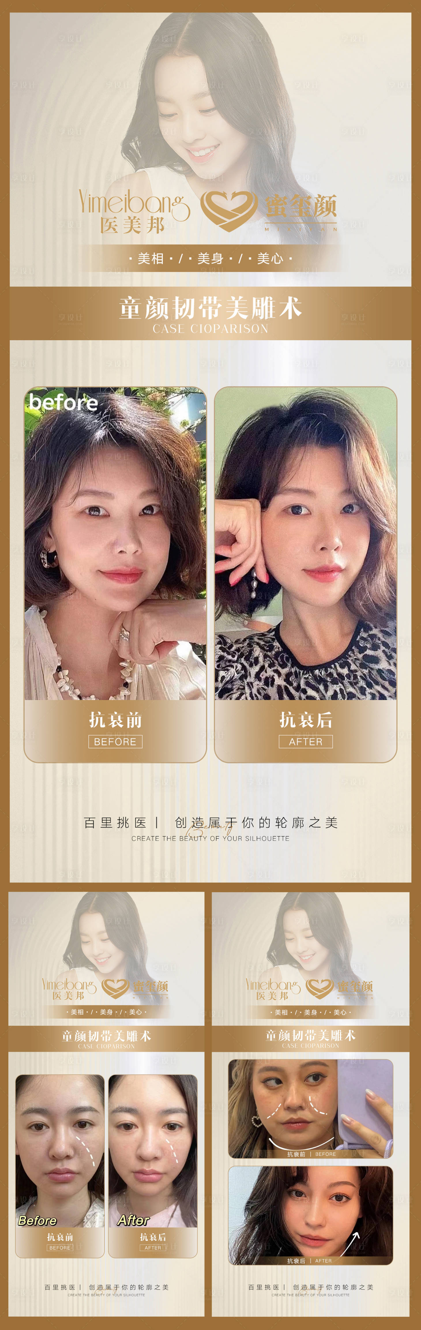 源文件下載【享設計】搜索編號：24200012296745157【醫美抗衰案例對比圖模板】