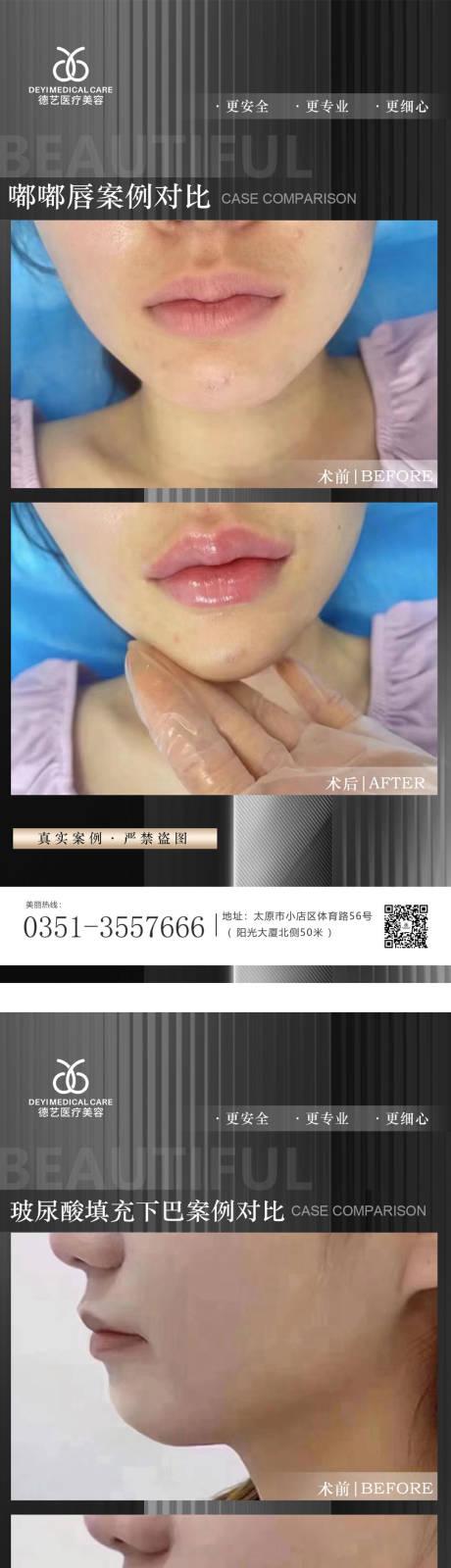 源文件下载【享设计】搜索编号：78500012047339413【医美案例对比图】