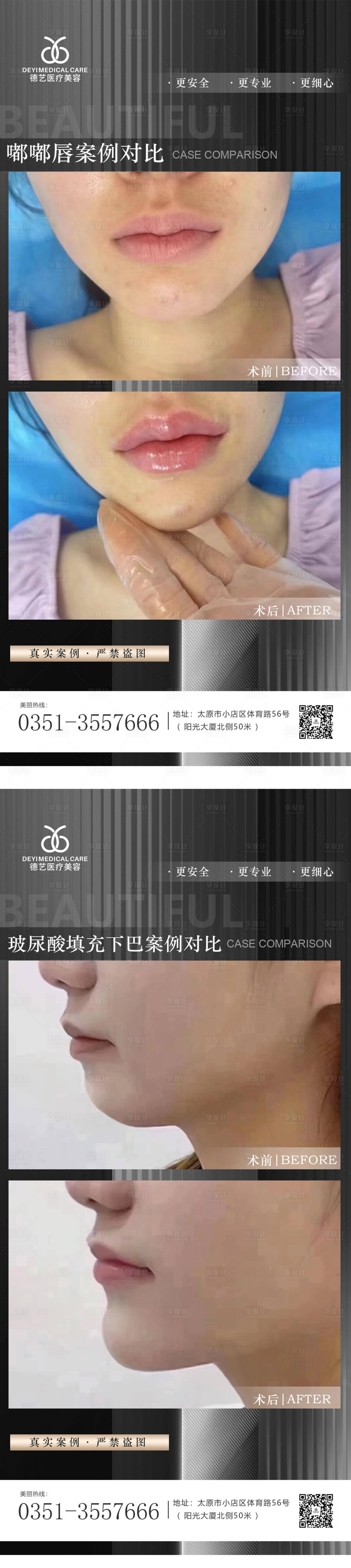 源文件下载【享设计】搜索编号：78500012047339413【医美案例对比图】