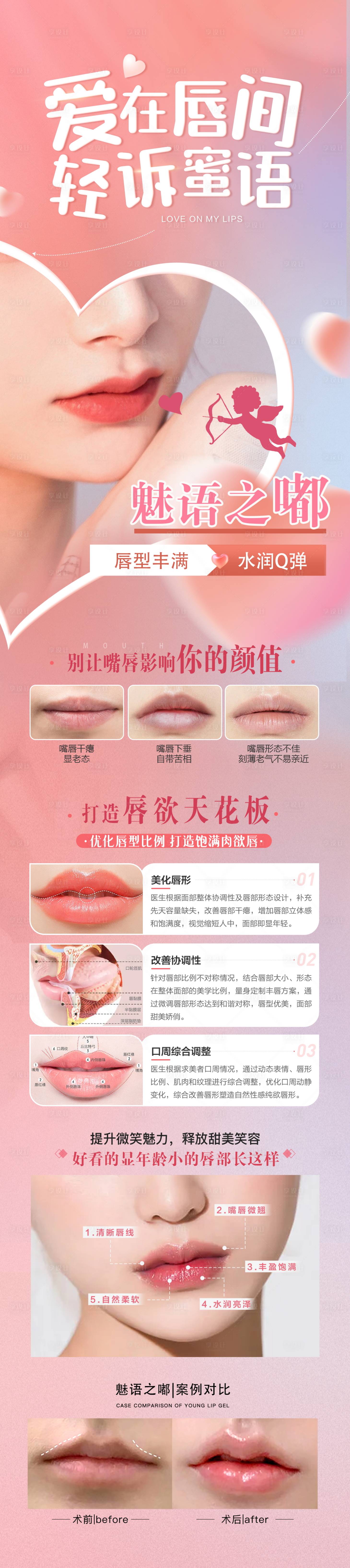 源文件下載【享設計】搜索編號：10820012039005787【醫美豐唇長圖】