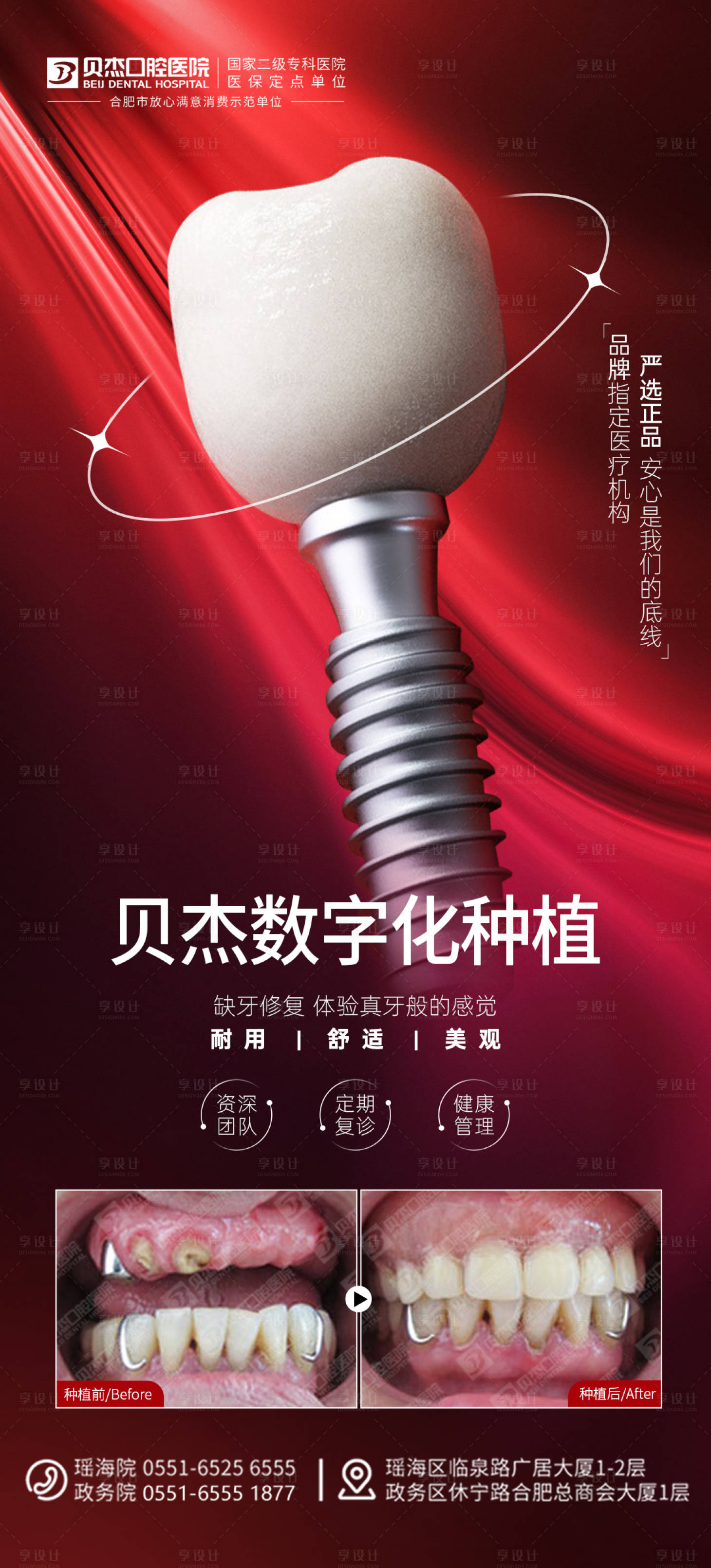 源文件下载【享设计】搜索编号：35550011986366434【种植牙】