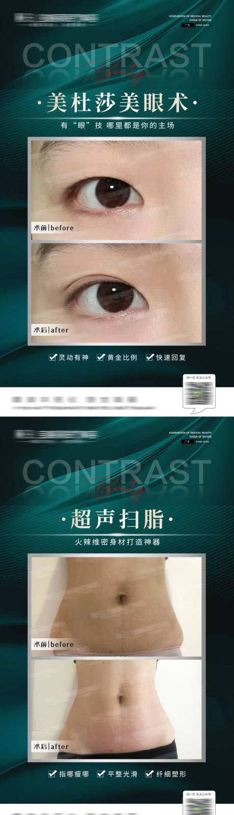 源文件下載【享設計】搜索編號：73680012162561831【醫美案例對比海報】