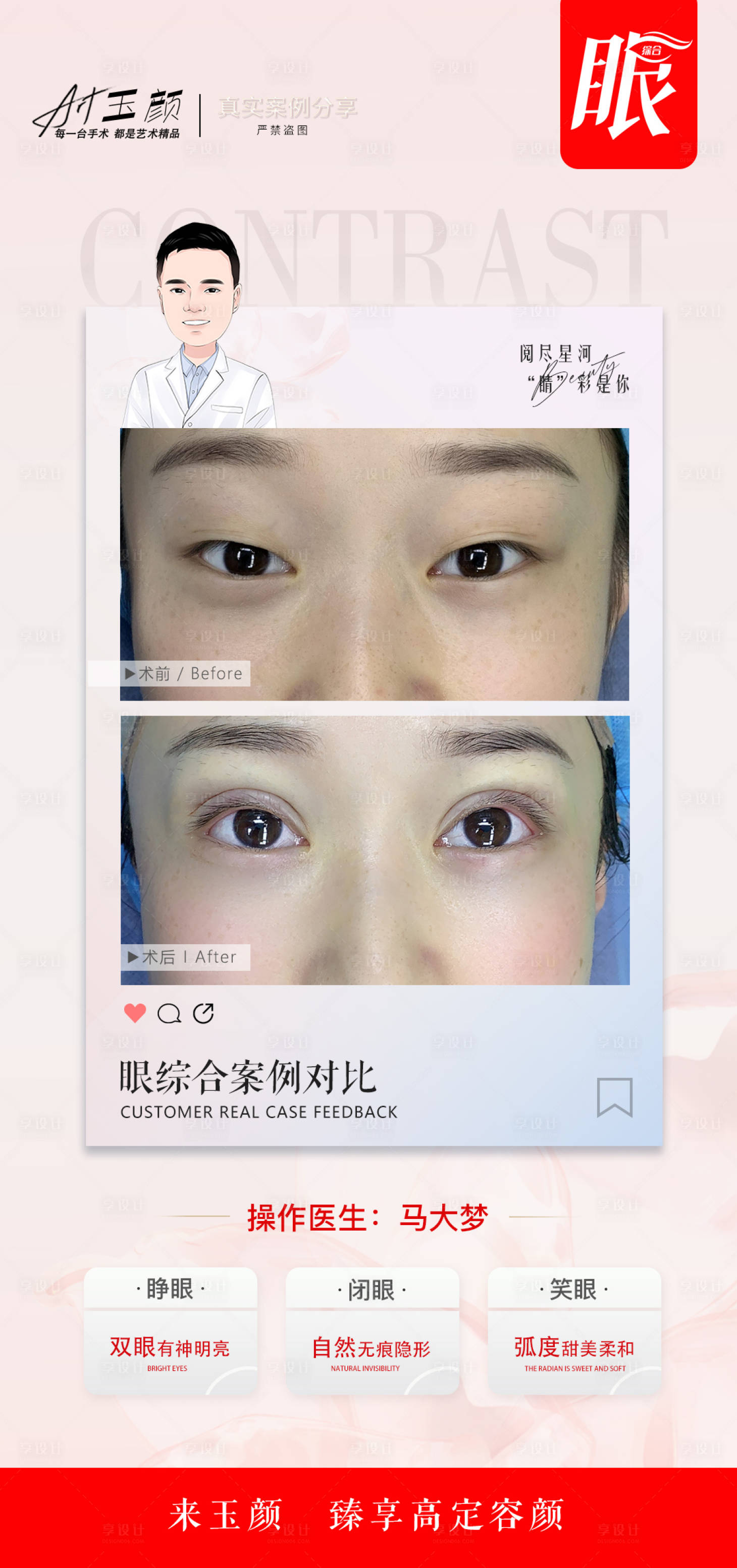 源文件下载【享设计】搜索编号：71620012042543024【医美案例眼综合海报】
