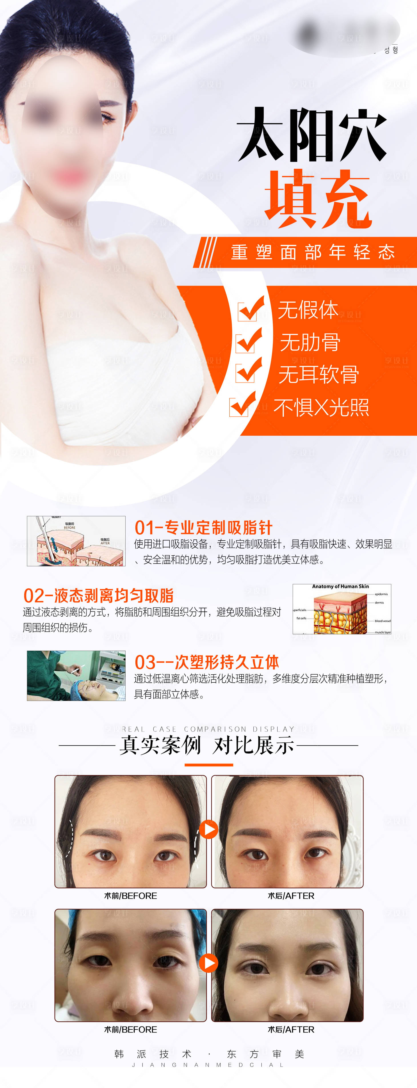 源文件下載【享設計】搜索編號：95450012855082105【醫美高端太陽穴填充海報長圖】