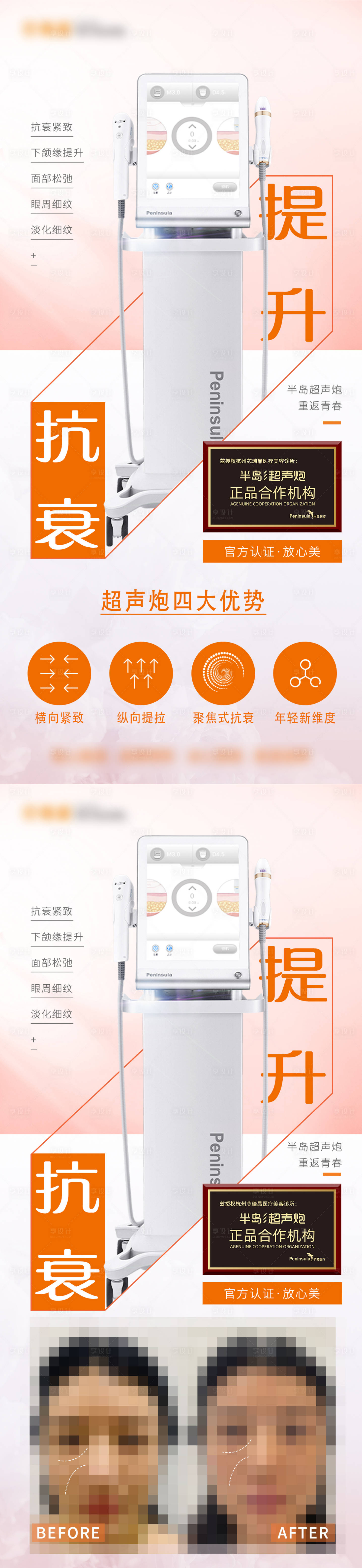 源文件下載【享設計】搜索編號：31800012609206565【超聲炮海報】