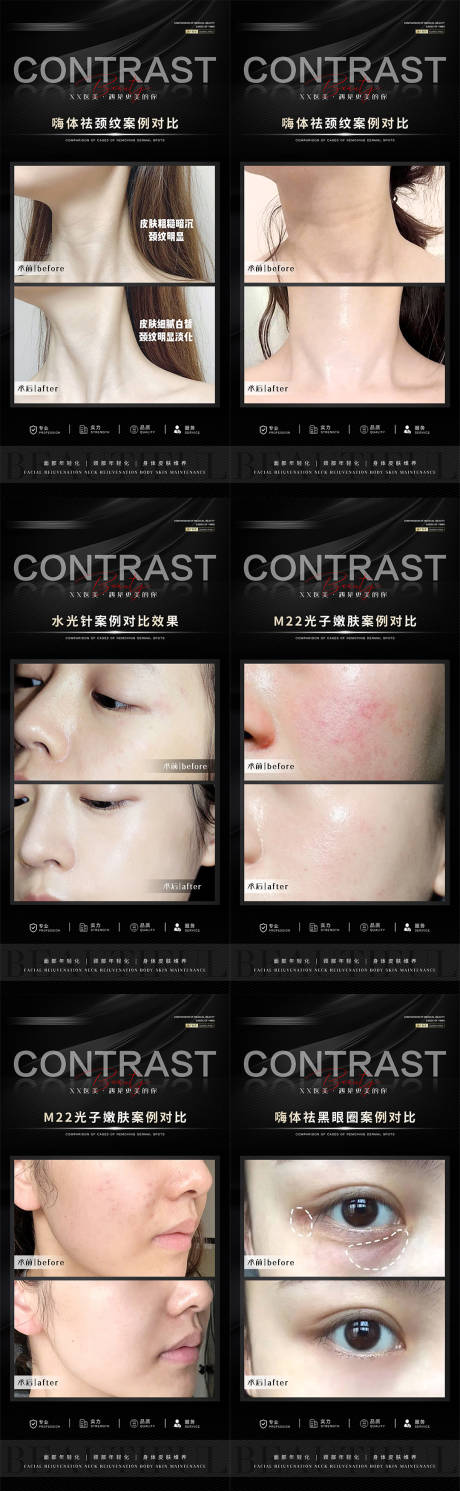 源文件下载【医美案例海报】编号：41490012766156723
