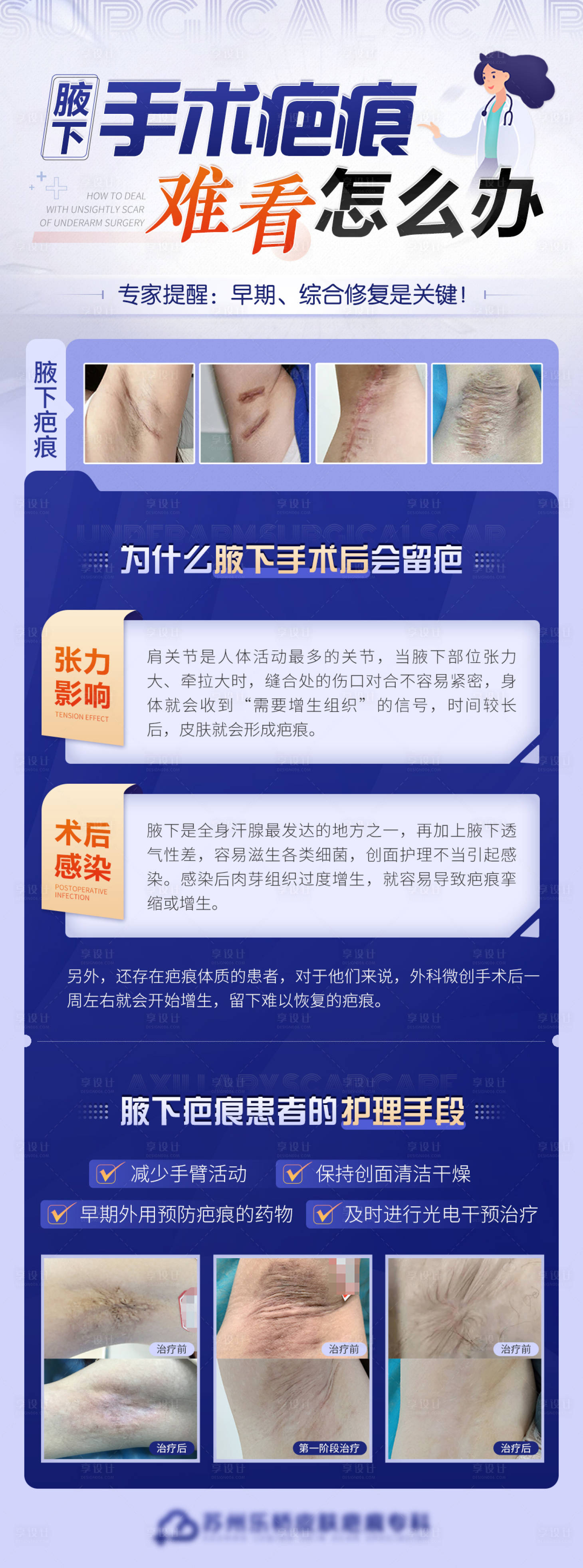 源文件下载【享设计】搜索编号：94540012645836722【医疗腋下手术疤痕难看怎么办长图海报】