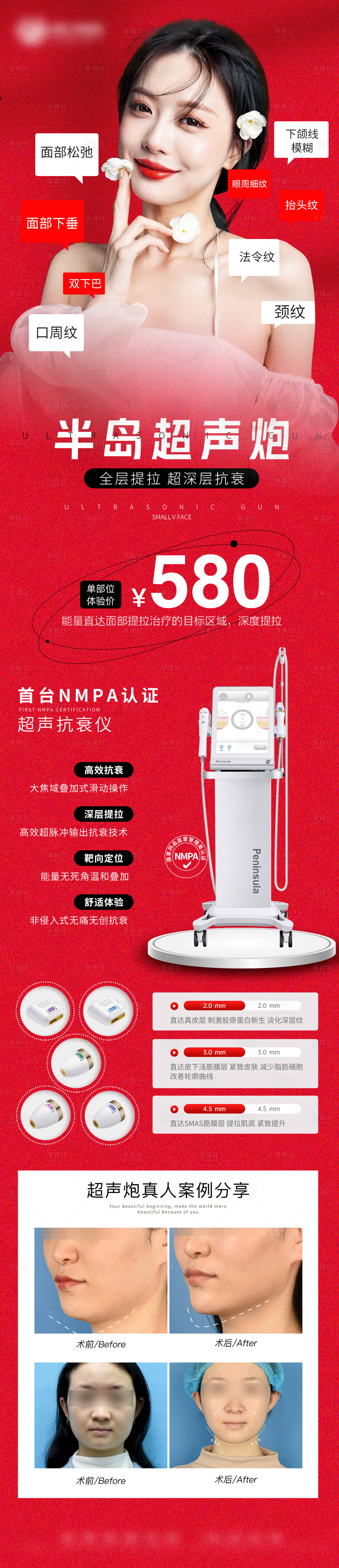 源文件下载【医美超声炮抗衰长图海报】编号：50770012719494750
