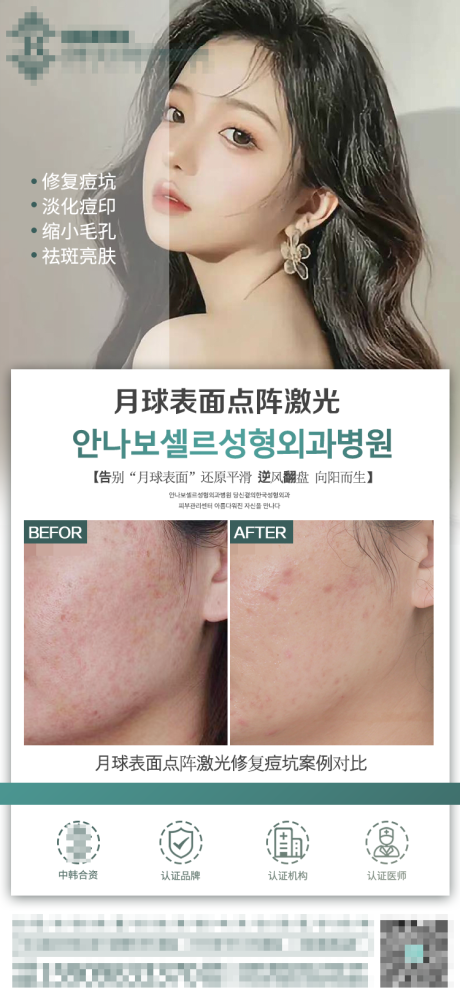 源文件下载【医美点阵激光海报】编号：37570012830651173