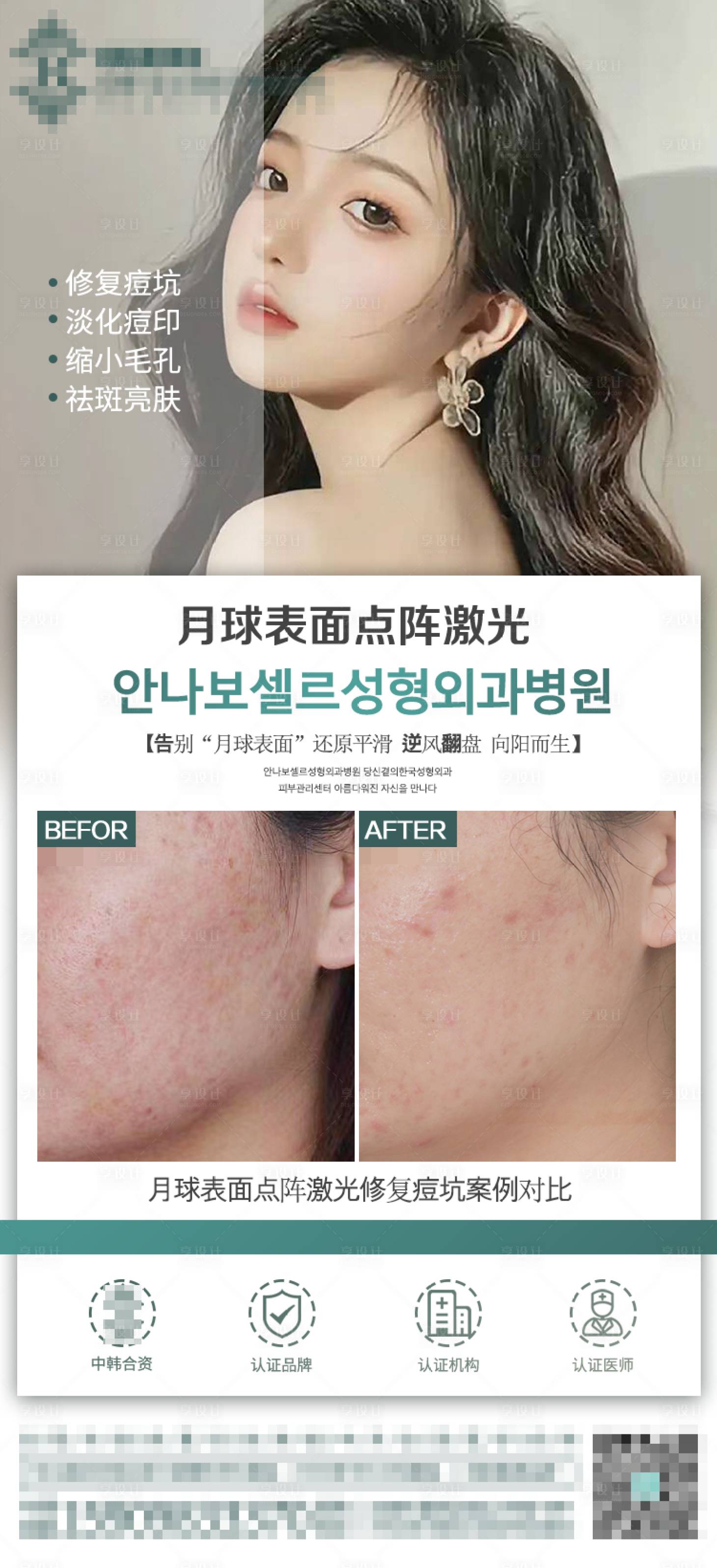 源文件下载【享设计】搜索编号：37570012830651173【医美点阵激光海报】