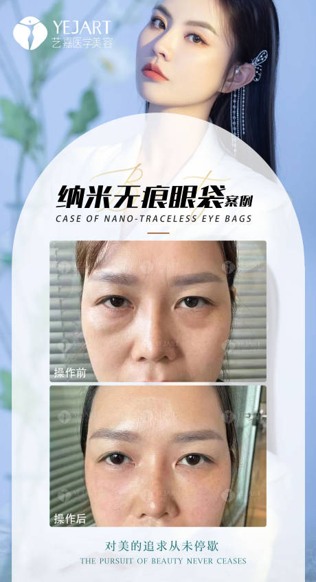 源文件下载【享设计】搜索编号：45150013029203554【医美案例】