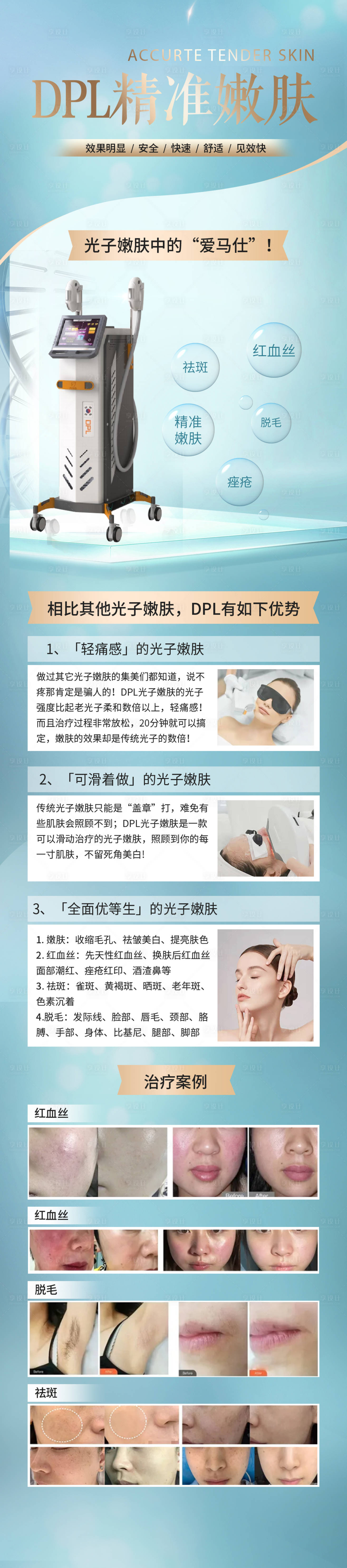 源文件下載【享設(shè)計(jì)】搜索編號(hào)：67480012583628604【醫(yī)美儀器長(zhǎng)圖海報(bào)】