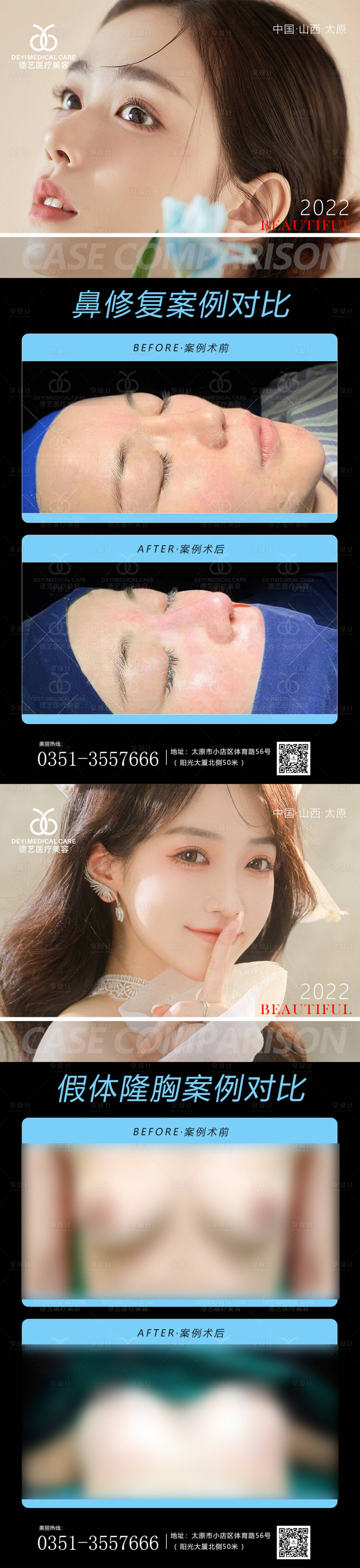 源文件下載【享設計】搜索編號：59280011417863487【醫美案例對比圖】