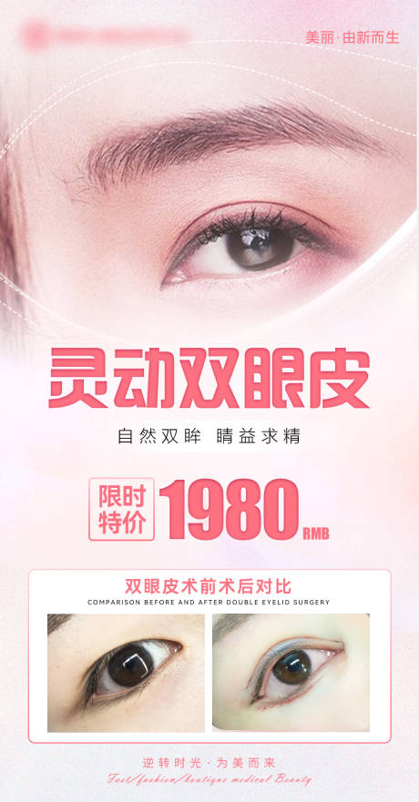 源文件下载【医美双眼皮海报】编号：43290012506637295
