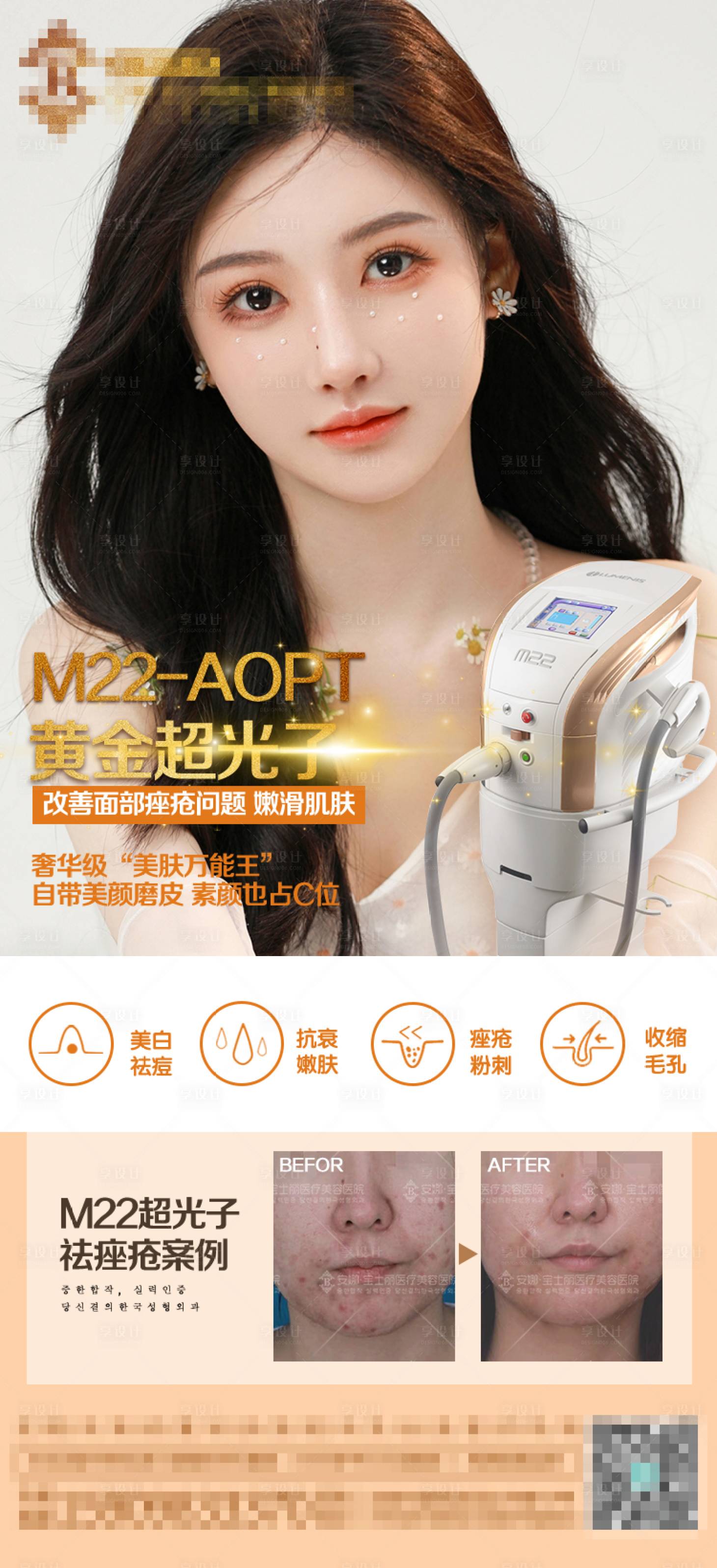 源文件下载【医美黄金超光子去痤疮案例海报】编号：26860012829558393