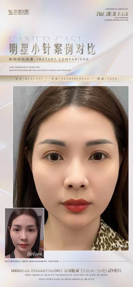 源文件下载【医美案例对比海报】编号：95980013012399275