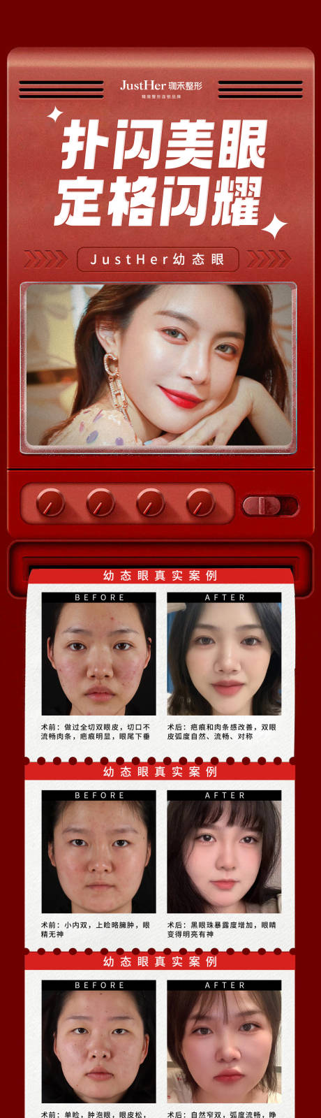源文件下载【医美案例长图】编号：29600012546891009