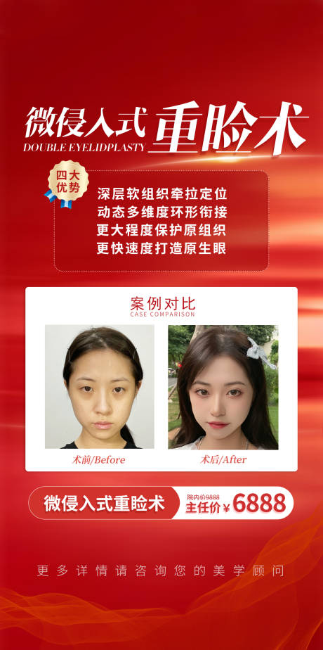 源文件下载【微轻入式重睑术海报】编号：65370012867496429