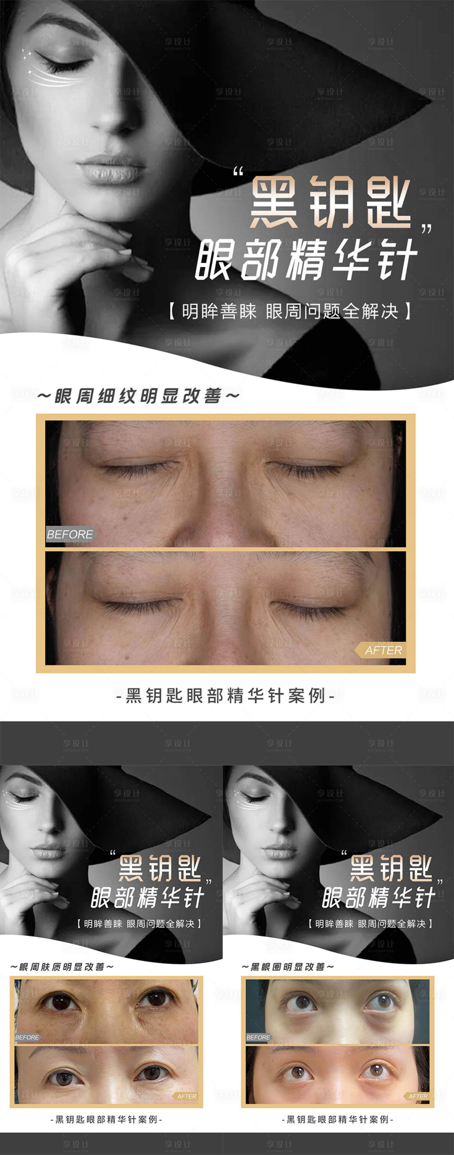 源文件下载【医美案例海报】编号：66440013001008036