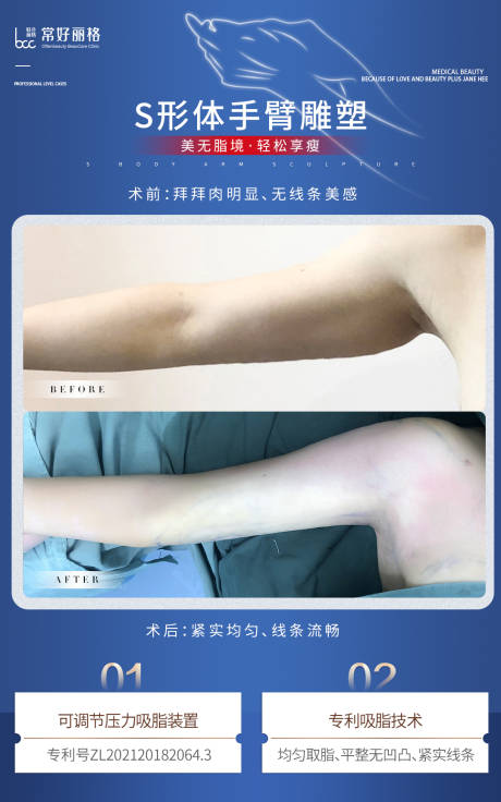 源文件下载【享设计】搜索编号：58050012918084931【医美案例对比海报】