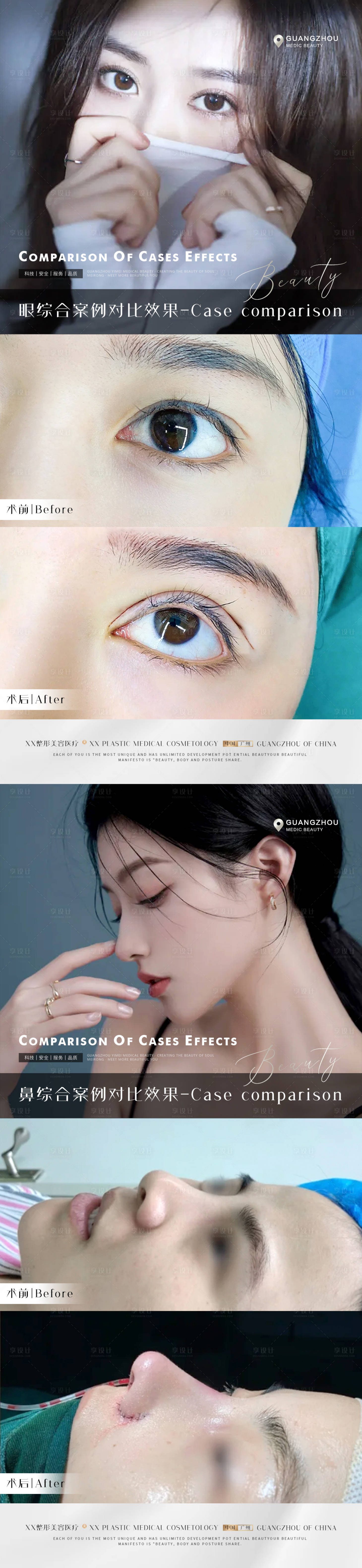 源文件下载【享设计】搜索编号：89500013006024729【医美案例海报】