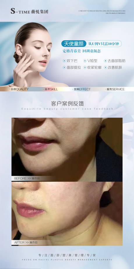 源文件下载【医美项目对比海报】编号：77400012518103091
