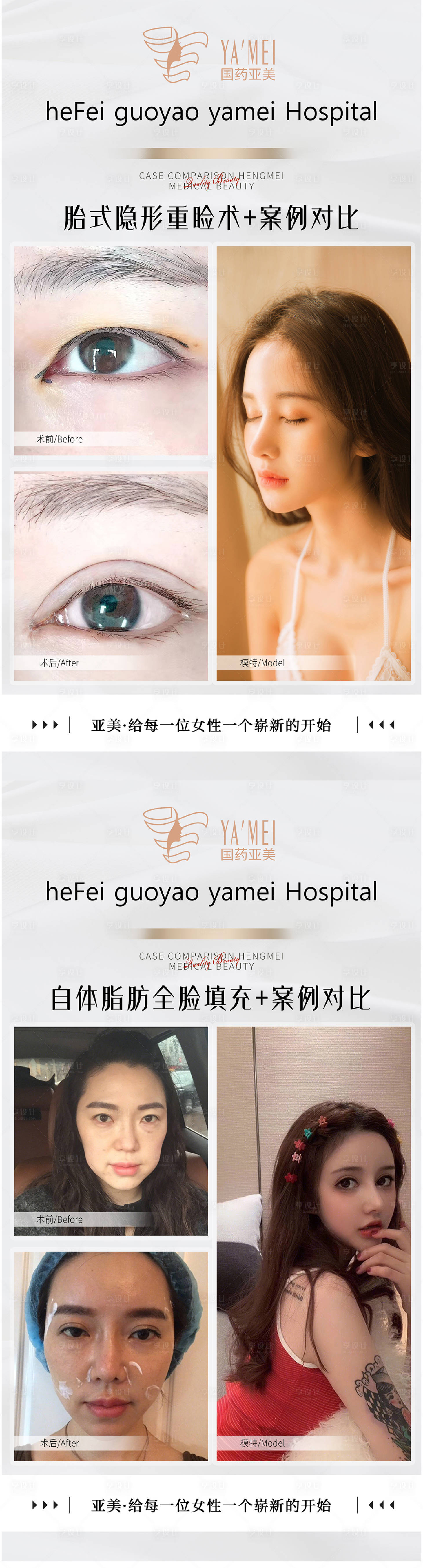 源文件下载【享设计】搜索编号：77000012732523920【案例对比图】