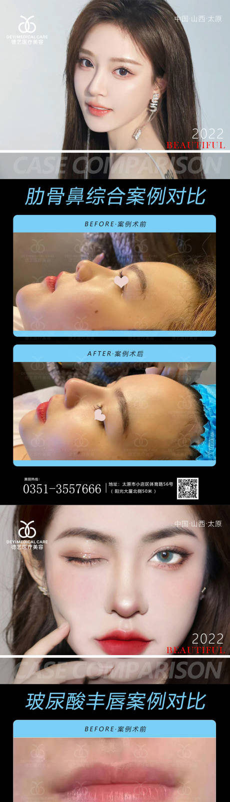 源文件下載【醫美案例對比圖】編號：98910012887368858