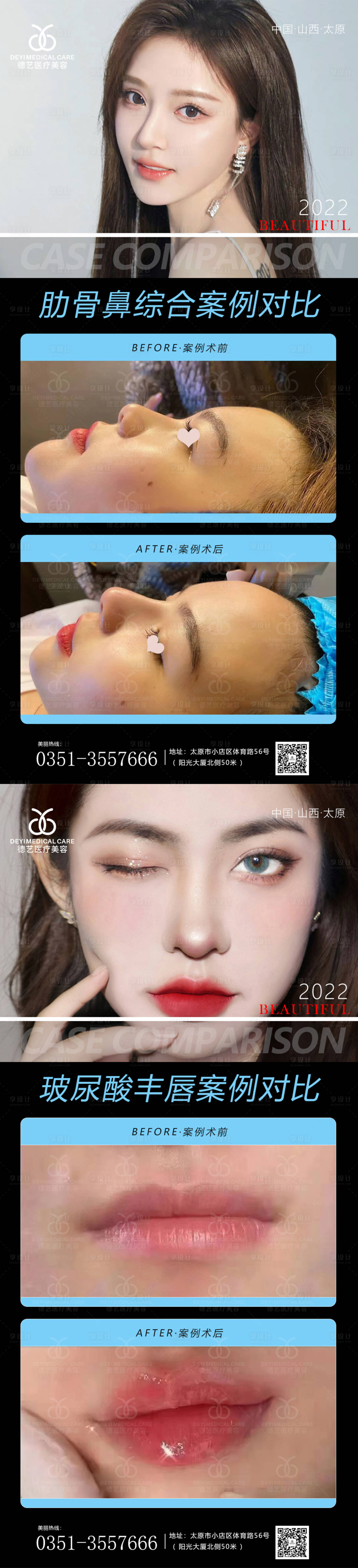 源文件下载【享设计】搜索编号：98910012887368858【医美案例对比图】