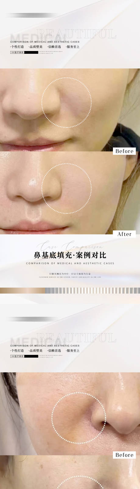 源文件下載【醫美案例海報】編號：19120012782259087
