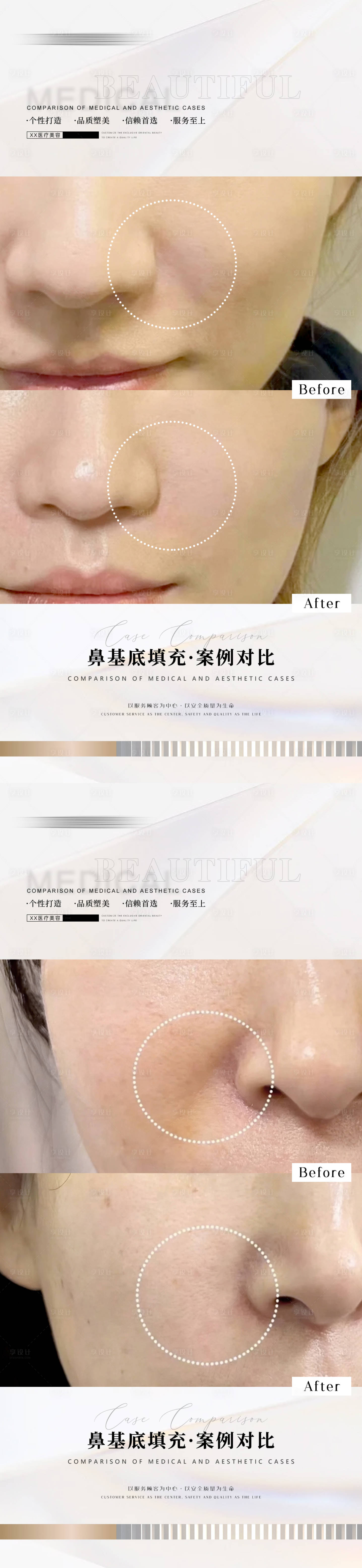 源文件下載【醫美案例海報】編號：19120012782259087