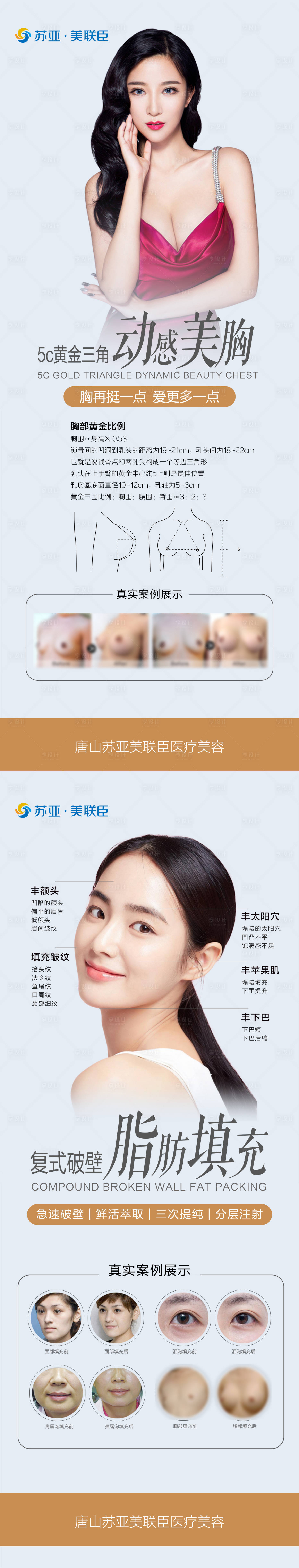 源文件下载【享设计】搜索编号：62600005706497480【医美隆胸自体脂肪填充系列海报】