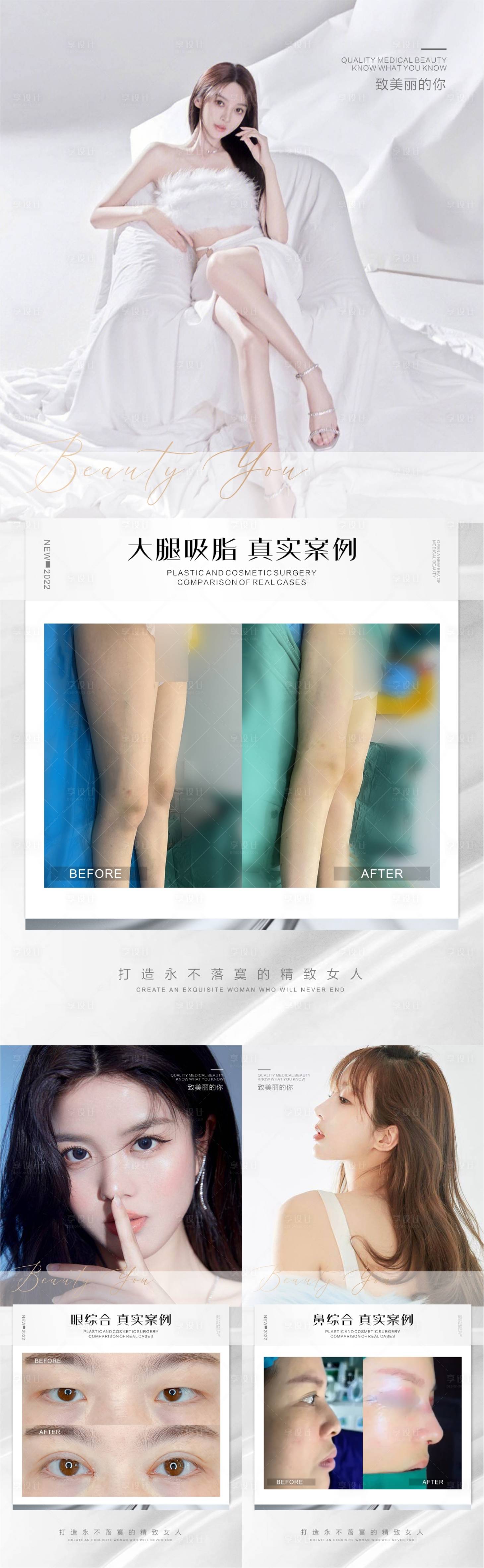 源文件下载【医美整形案例系列】编号：44320012648532713
