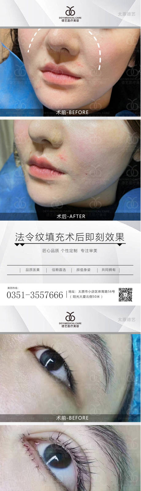 源文件下载【医美案例对比图】编号：20220714111121146